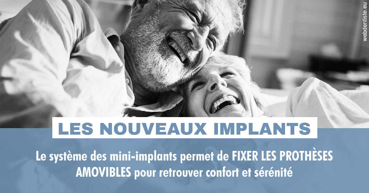 https://dr-bluche-laurent.chirurgiens-dentistes.fr/Les nouveaux implants 2