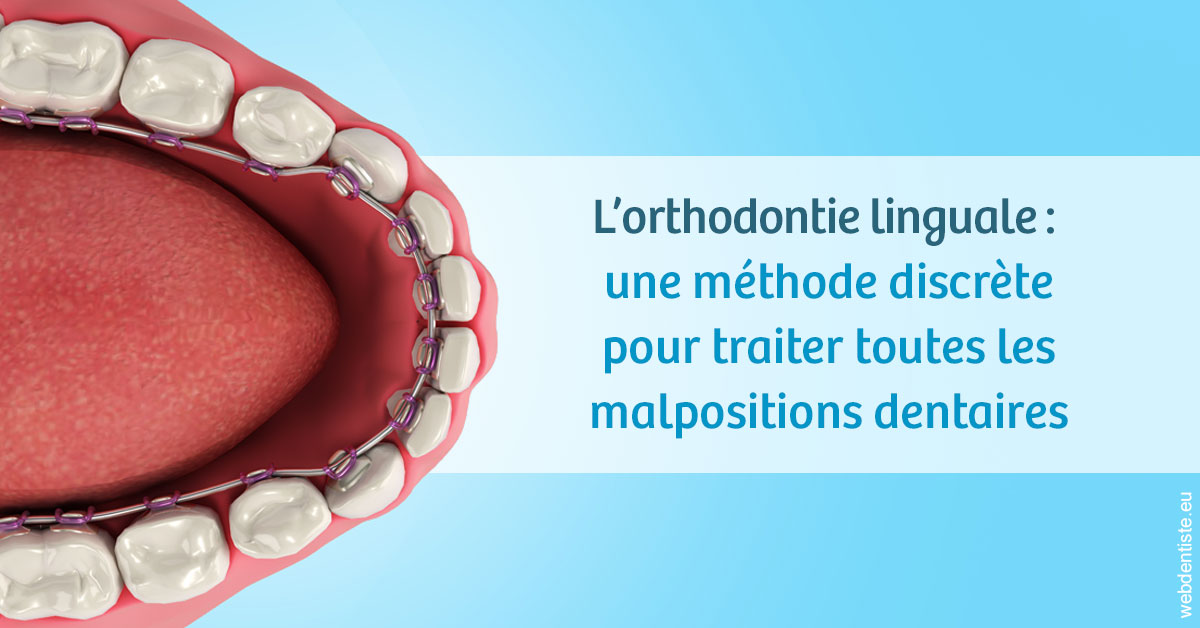 https://dr-bluche-laurent.chirurgiens-dentistes.fr/L'orthodontie linguale 1