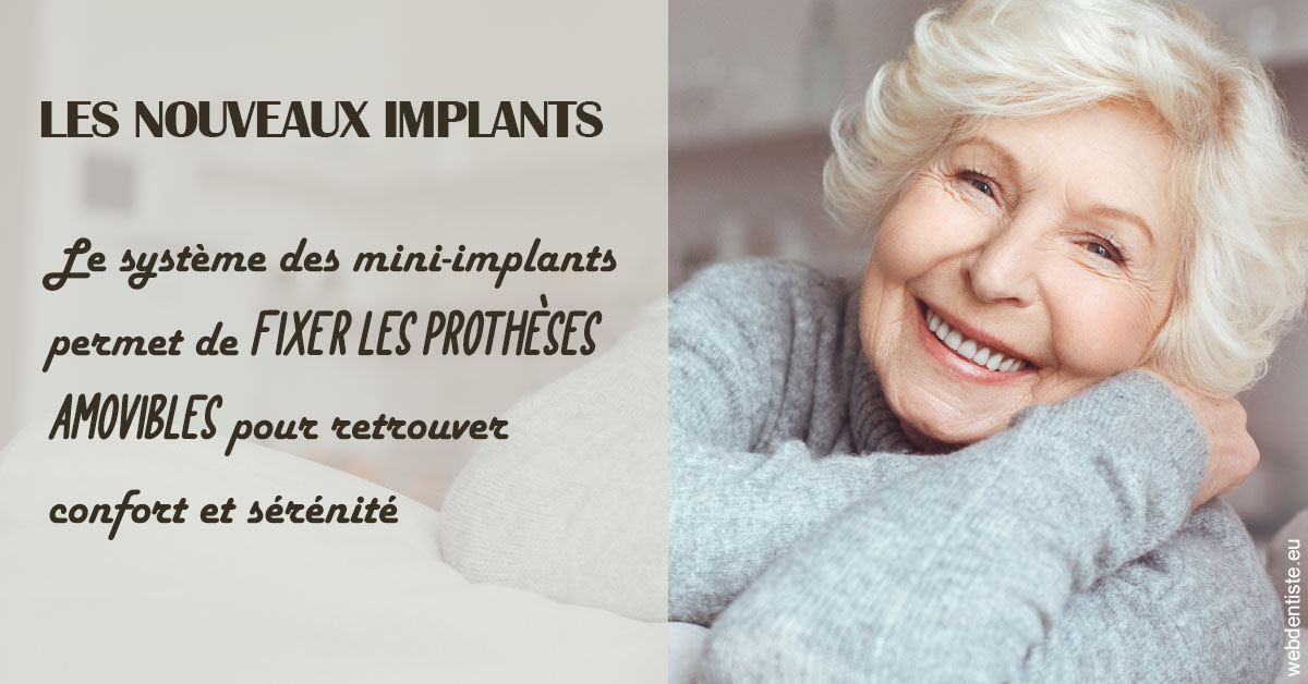 https://dr-bluche-laurent.chirurgiens-dentistes.fr/Les nouveaux implants 1