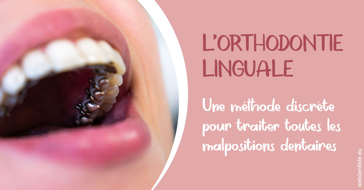 https://dr-bluche-laurent.chirurgiens-dentistes.fr/L'orthodontie linguale 2