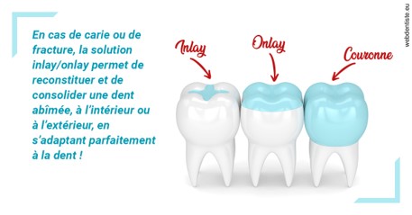 https://dr-bluche-laurent.chirurgiens-dentistes.fr/L'INLAY ou l'ONLAY