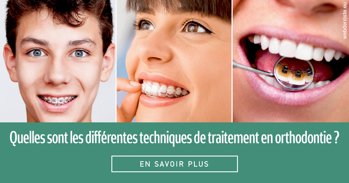 https://dr-bluche-laurent.chirurgiens-dentistes.fr/Les différentes techniques de traitement 2