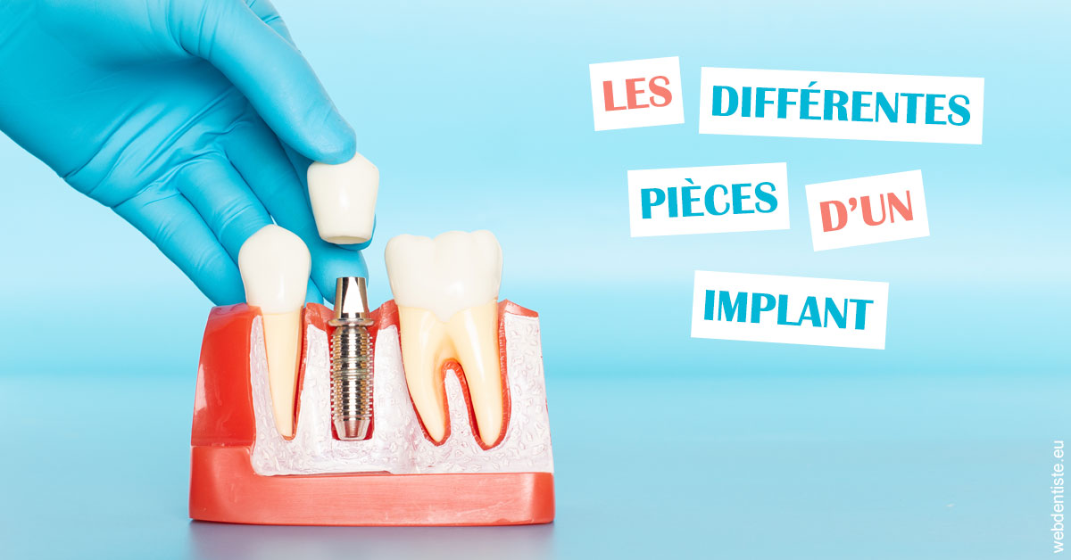 https://dr-bluche-laurent.chirurgiens-dentistes.fr/Les différentes pièces d’un implant 2