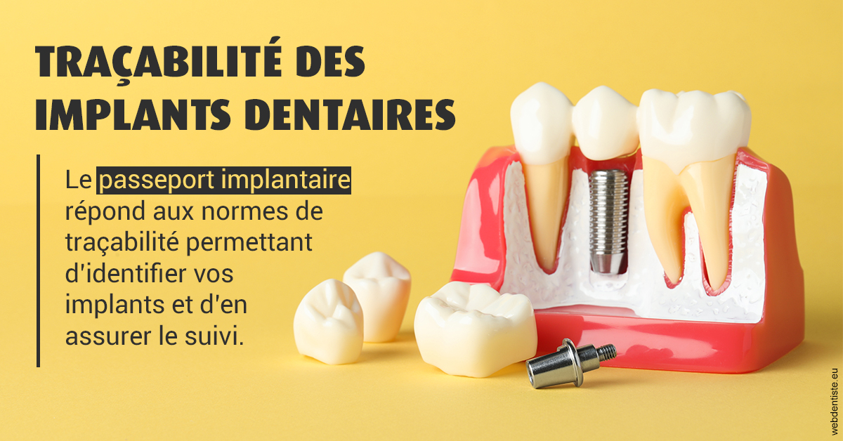 https://dr-bluche-laurent.chirurgiens-dentistes.fr/T2 2023 - Traçabilité des implants 2