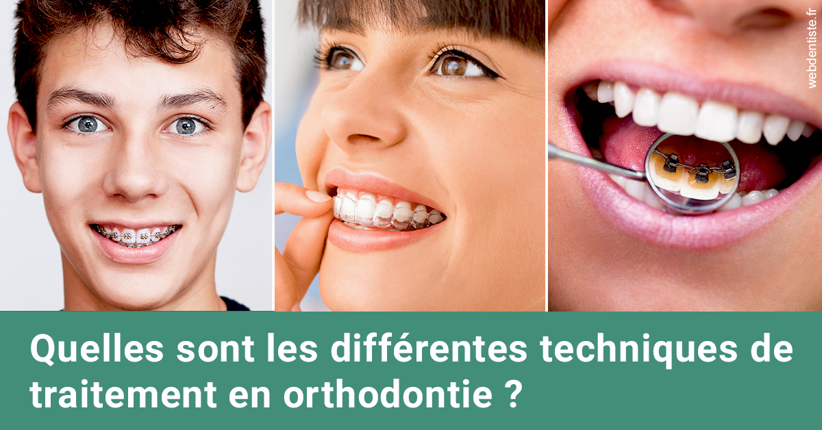 https://dr-bluche-laurent.chirurgiens-dentistes.fr/Les différentes techniques de traitement 2