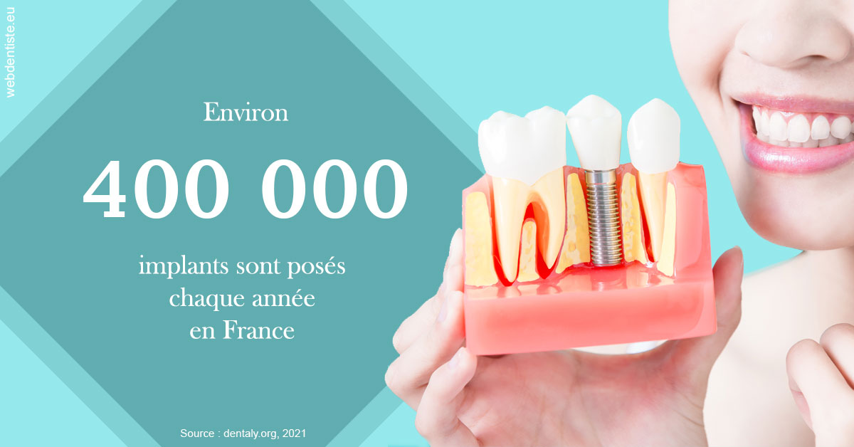 https://dr-bluche-laurent.chirurgiens-dentistes.fr/Pose d'implants en France 2